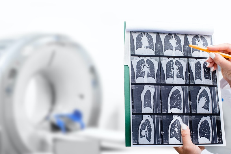 doctor looking at lung imaging